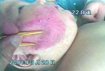 �A�g�s�[���畆���̏Ǘ�