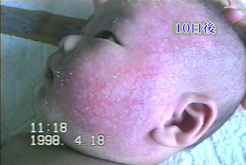 �A�g�s�[���畆���̏Ǘ�