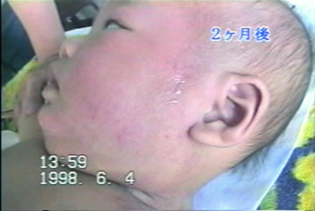 �A�g�s�[���畆���̏Ǘ�